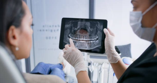 Licensed Tooth Extraction service in Laurens County County, SC - Smile Center Dentistry